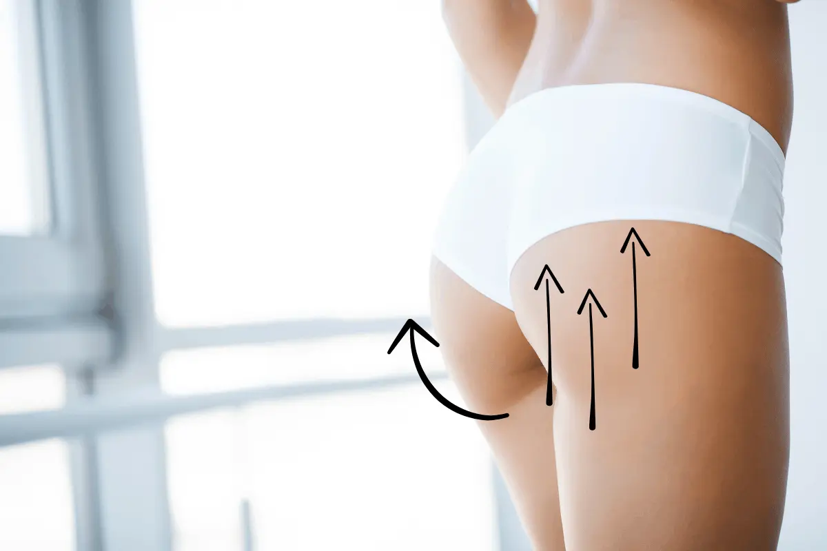 Lifting Glutei
